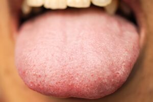 supertaster's tongue