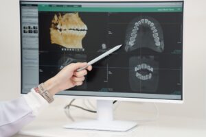 dental x-rays