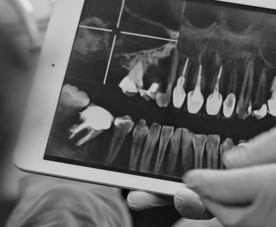 dental x-rays