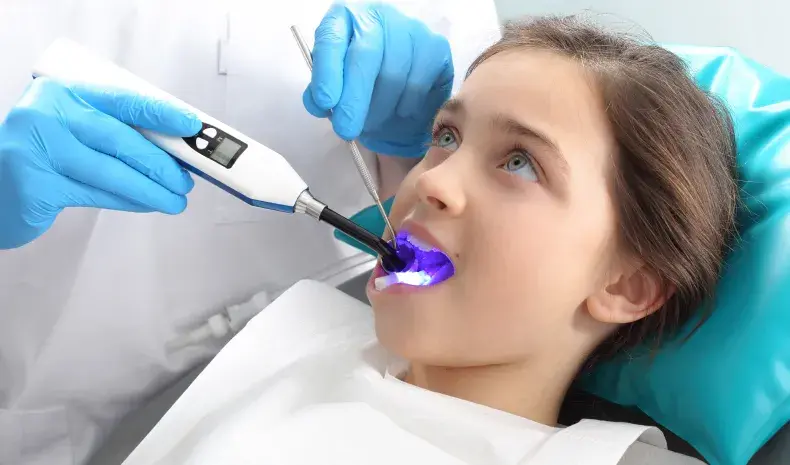 dental sealants