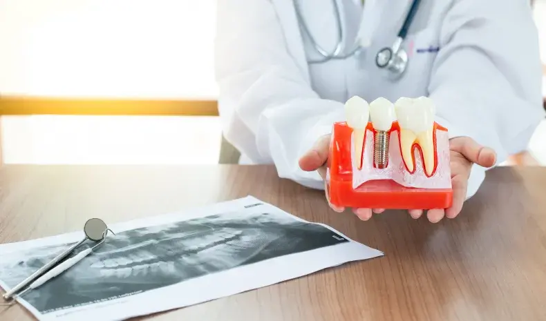 dental x-rays and dental implants at Citrus Smiles Dental Studio