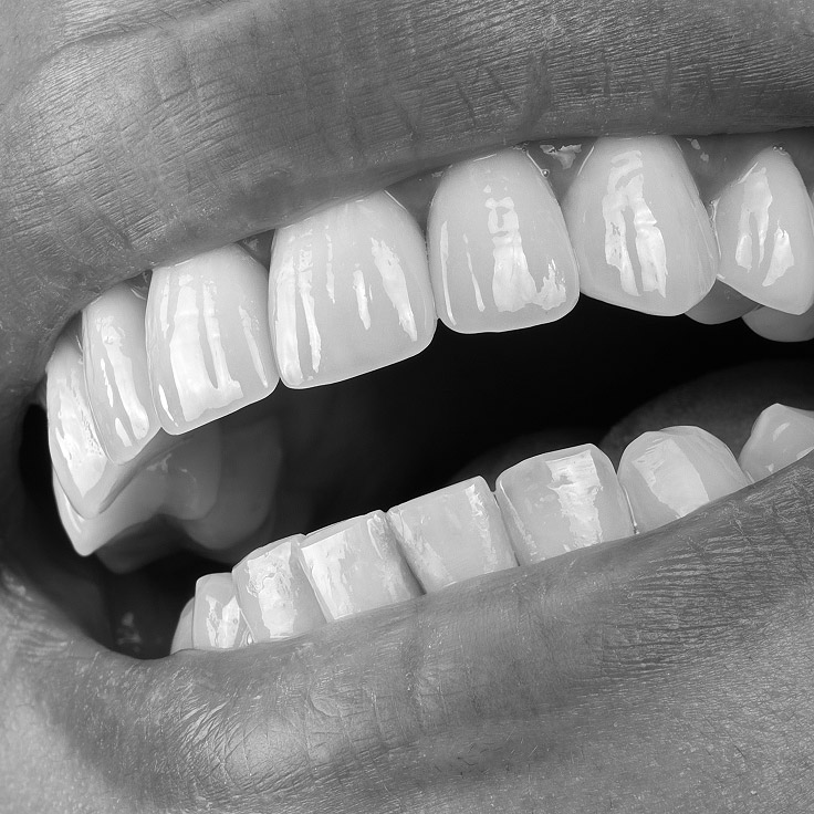 cosmetic dentistry at Citrus Smiles Dental Studio