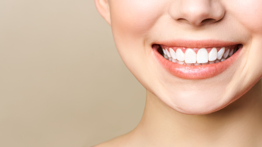 Smiling woman showcasing bright, white teeth, emphasizing the results of professional teeth whitening treatments at Citrus Smiles Dental Studio.