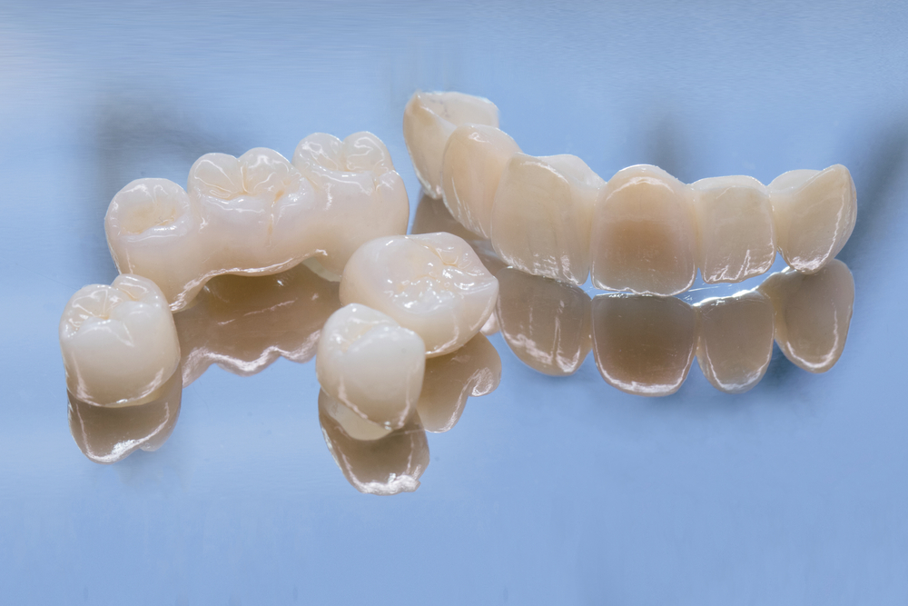 Metal,Free,Ceramic,Dental,Crowns.,Ceramic,Zirconium,In,Final,Version. Dental bridges displayed on reflective surface, showcasing various types and materials used in restorative dentistry, relevant to dental care and options at Citrus Smiles Dental Studio.