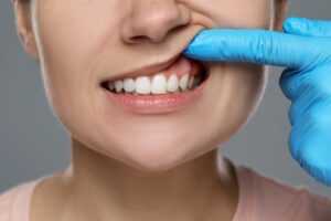 dentist examining woman's gums