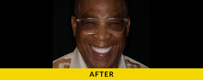 after treatment at Citrus Smiles Dental Studio