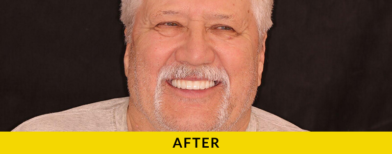 after treatment at Citrus Smiles Dental Studio