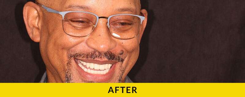 after treatment at Citrus Smiles Dental Studio