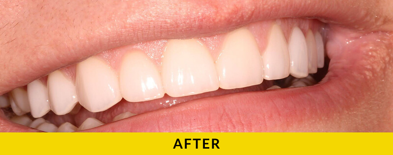 after treatment at Citrus Smiles Dental Studio