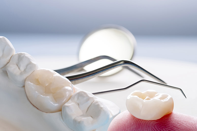 restorative dentistry at Citrus Smiles Dental Studio