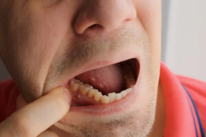gums and your oral health